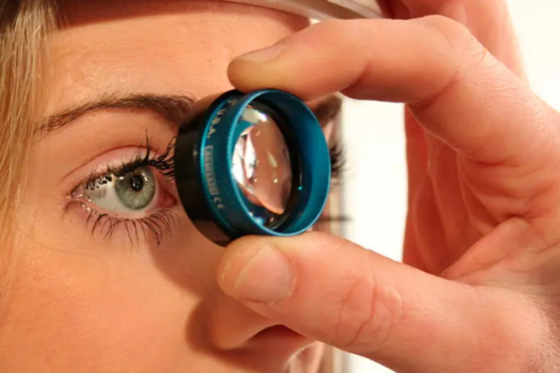  Glaucoma: la amenaza silenciosa que puede llevar a la ceguera