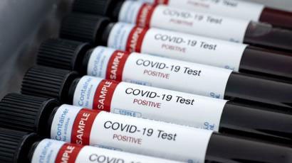  Coronavirus en Tornquist: Se confirmaron 15 casos positivos 